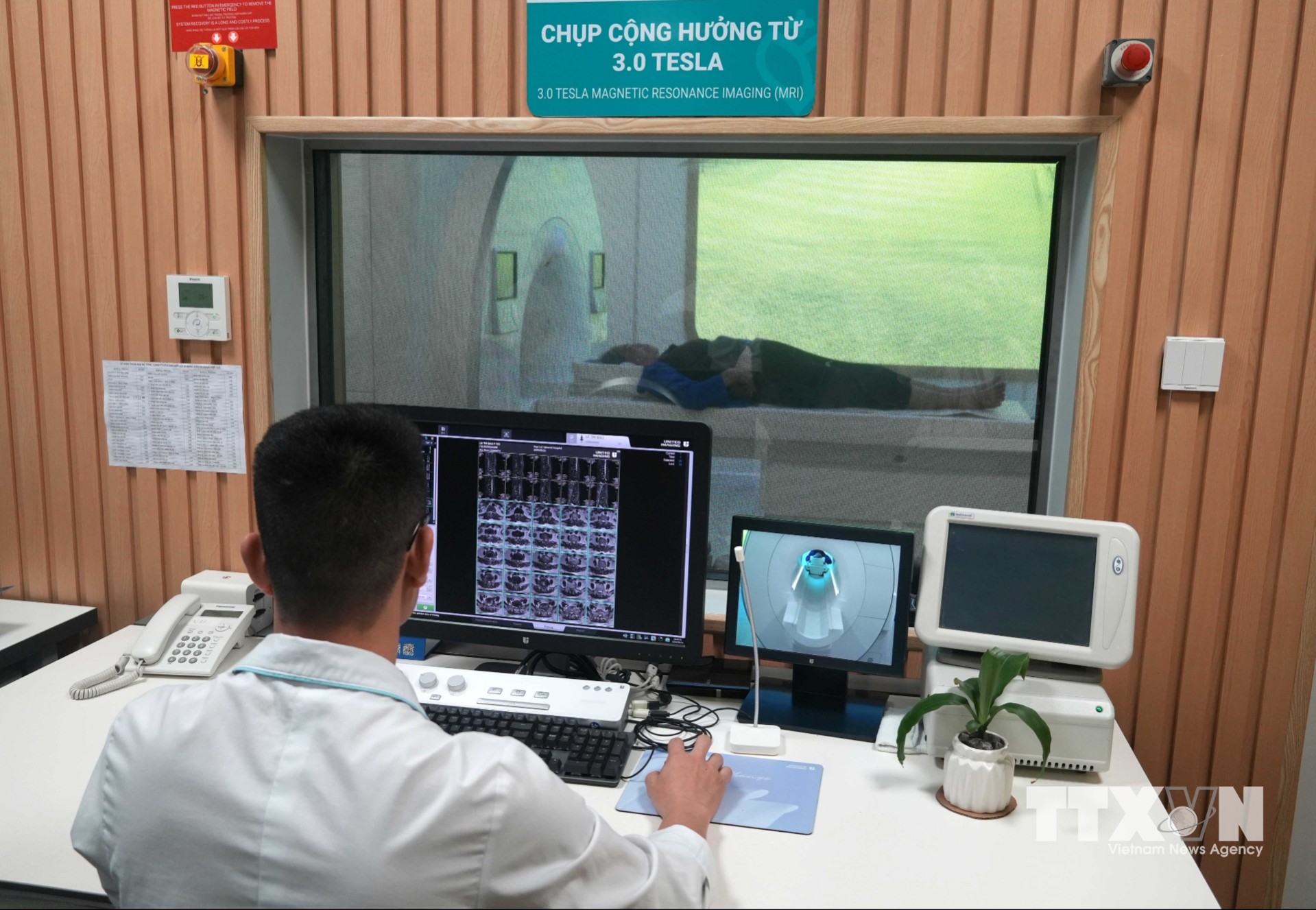 Hệ thống chụp cộng hưởng từ 3.0 Tesla uMR 780 tích hợp trí tuệ nhân tạo với nền tảng AI hỗ trợ tái tạo hình ảnh, nâng cao độ phân giải và rút ngắn thời gian chụp cho bệnh nhân. (Ảnh: Việt Hoàng/TTXVN)